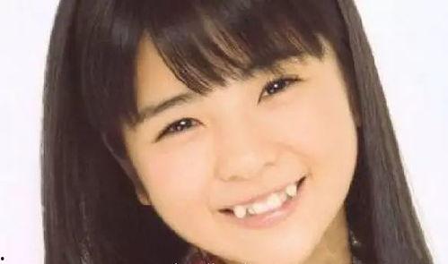 哪些明星长了虎牙,盘点那些笑起来甜到心坎的明星